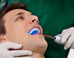 Using light to harden dental sealants for male patient