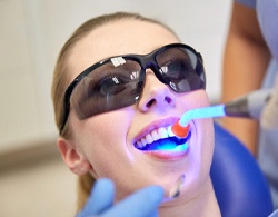 A young female wearing protective eyewear having composite resin bonded to her teeth
