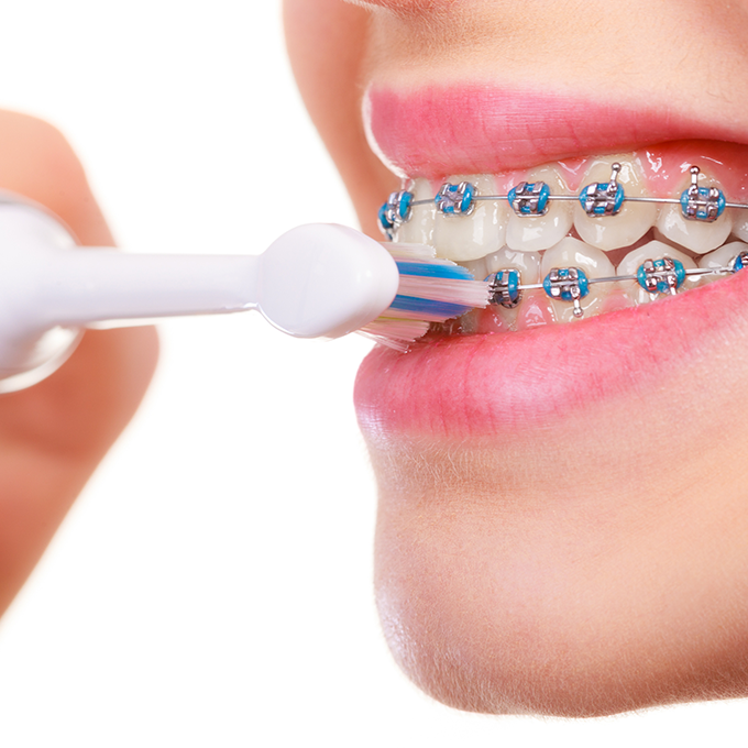 Blonde woman with braces flossing her teeth