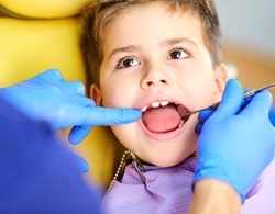 A little boy having his teeth checked