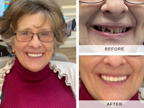Actual patient results before and after