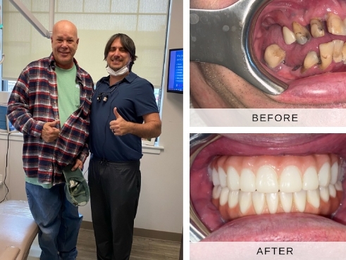 Actual patient results before and after