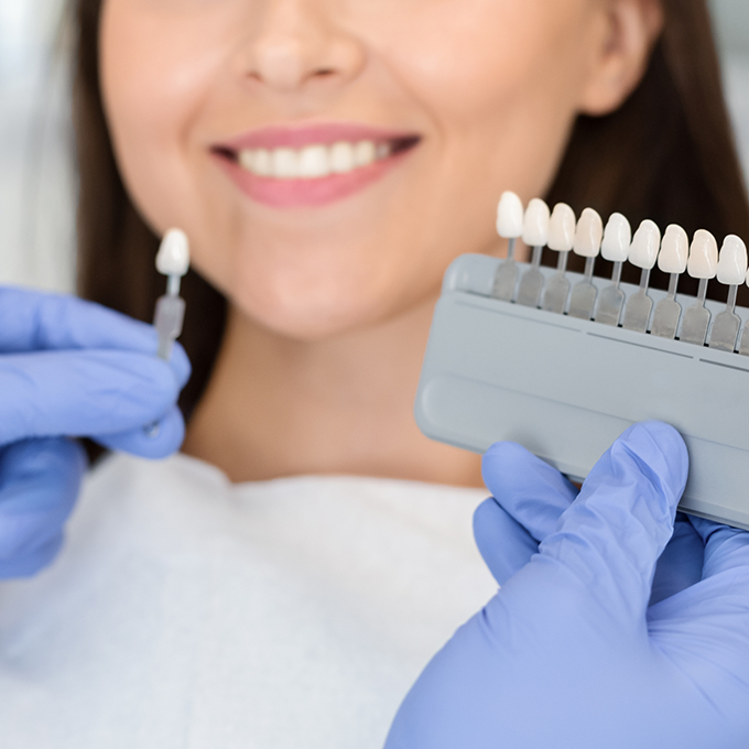 Holding shade match guide used to plan cosmetic dentistry