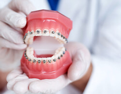 the cost of traditional braces in Thorndale