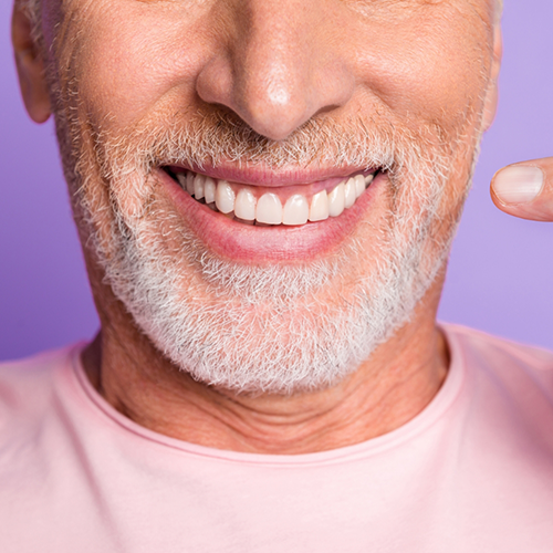 How Dental Implants Can Save You Money