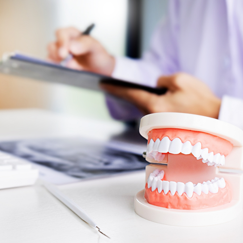 Does My Dental Insurance Cover Dental Implants?