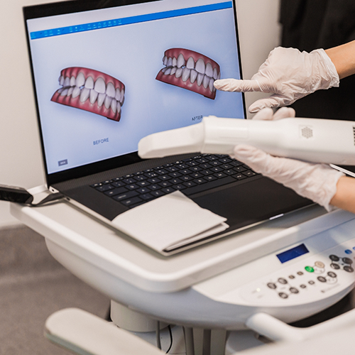 Guided Dental Implant Surgery