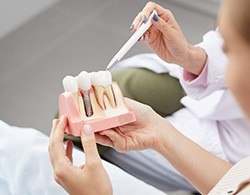Thorndale dental implant dentist explaining dental implants with model
