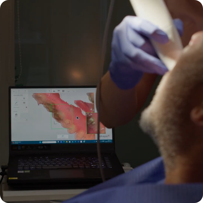 3D digital scan of a patient during implant planning
