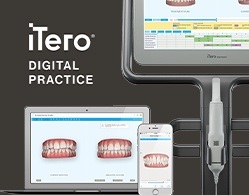 iTero digital impression and Invisalign treatment planning system