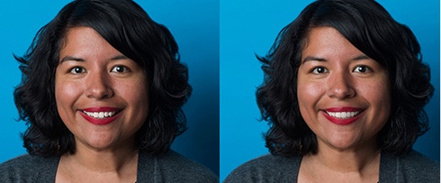 Patient smiling before and after Invisalign treatment