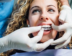 Female patient seeing dentist about Invisalign aligners