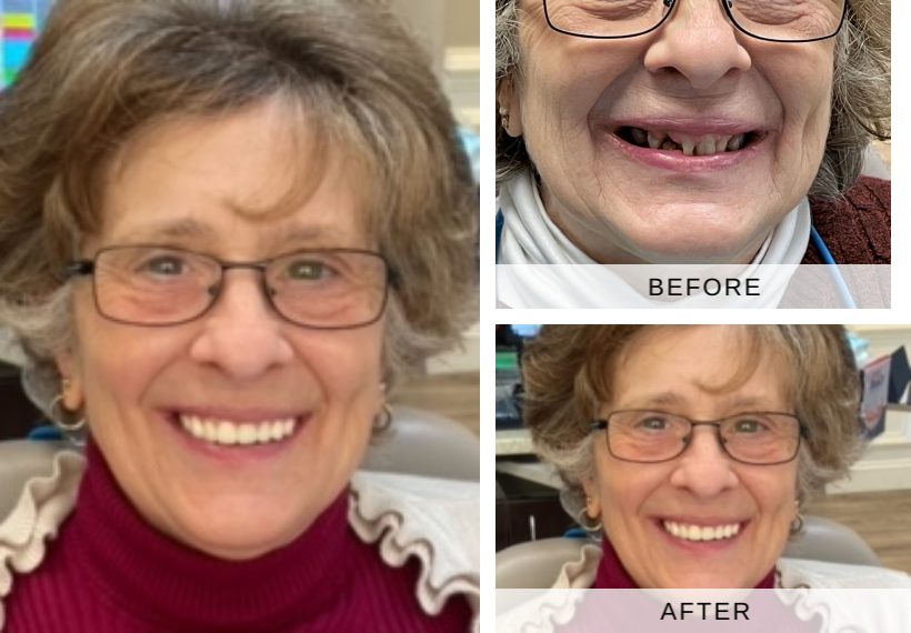 Patient Mary before and after