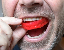 Man placing athletic mouthguard