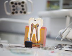 Model of the inside of a tooth before root canal therapy