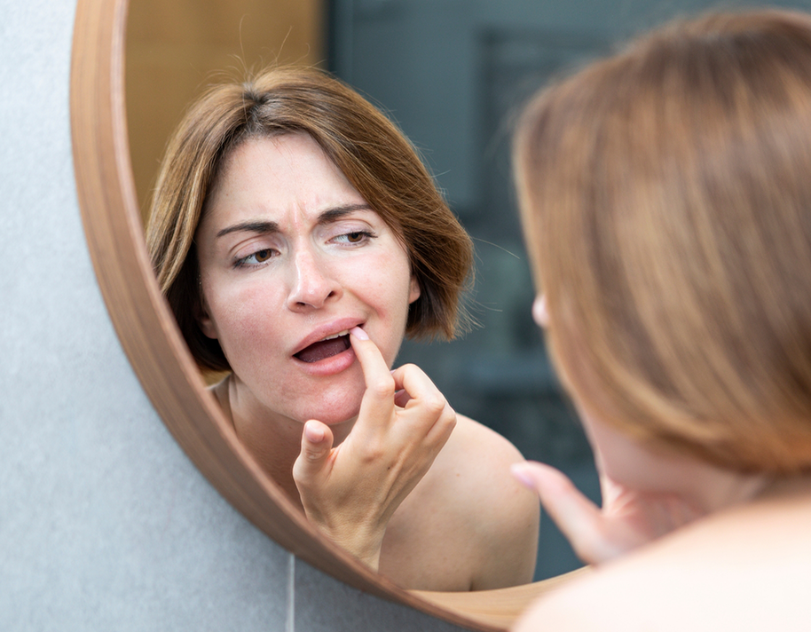 Woman checking her teeth in a mirror