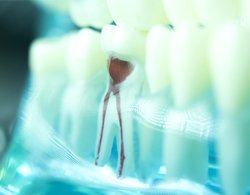 Model of a tooth showing the pulp and root canals