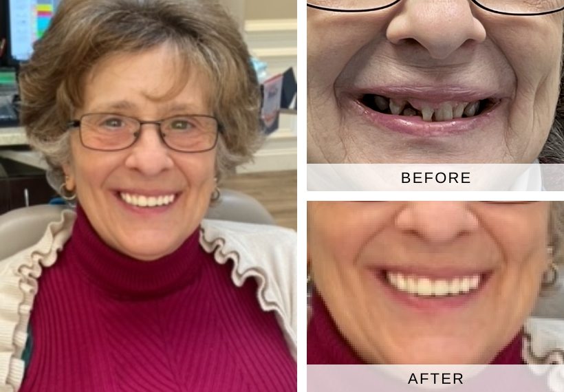 Mary H before during and after dental treatment