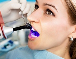 A curing light being used on a female patient's tooth colored filling