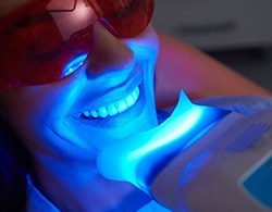 Woman receiving whitening treatment