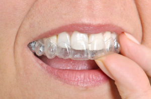 wearing invisalign