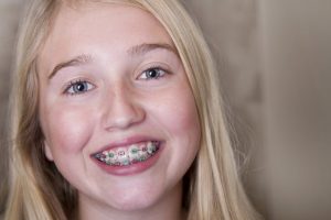 A young girl with braces.