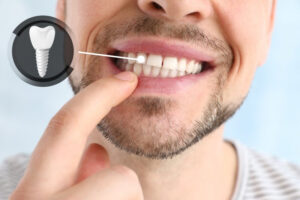 Man checking to see if his dental implant is failing