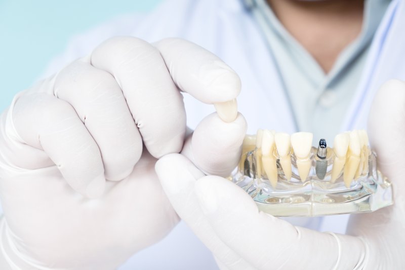 A dentist holding up an enlarged dental implant model